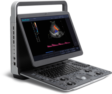 Ultrasonograf przenośny SonoScape E3 z głowicą liniową 4-16 MHz, convex 1-7 MHz i dopochwową 3-15 MHz