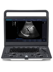 Ultrasonografy nowe