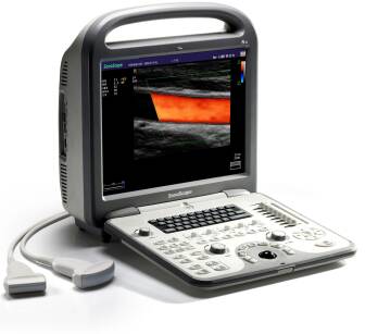 Ultrasonograf SonoScape S6 (prod. 2014) z NOWĄ głowicą