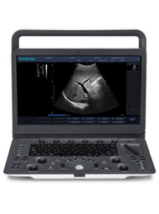 Ultrasonograf przenośny SonoScape E1 z głowicą liniową 5-12 MHz, convex 2-6 MHz, endovaginalną 3-15 MHz
